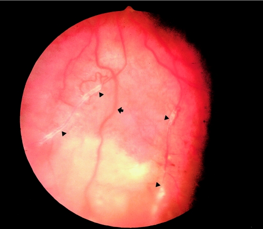 Figure  2