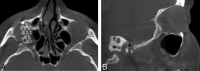Fig 6.