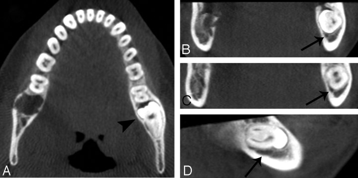 Fig 2.