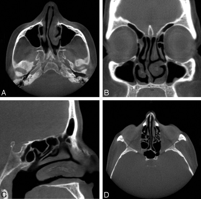 Fig 3.