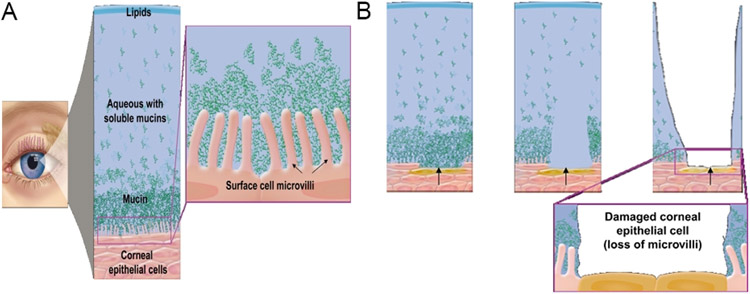 Figure 1 –