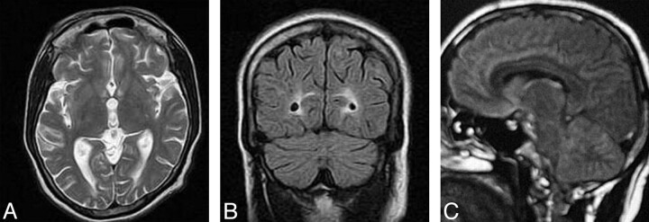 Fig 2.