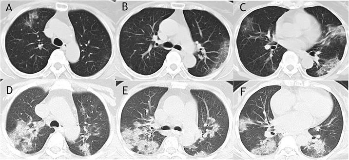 Fig 2