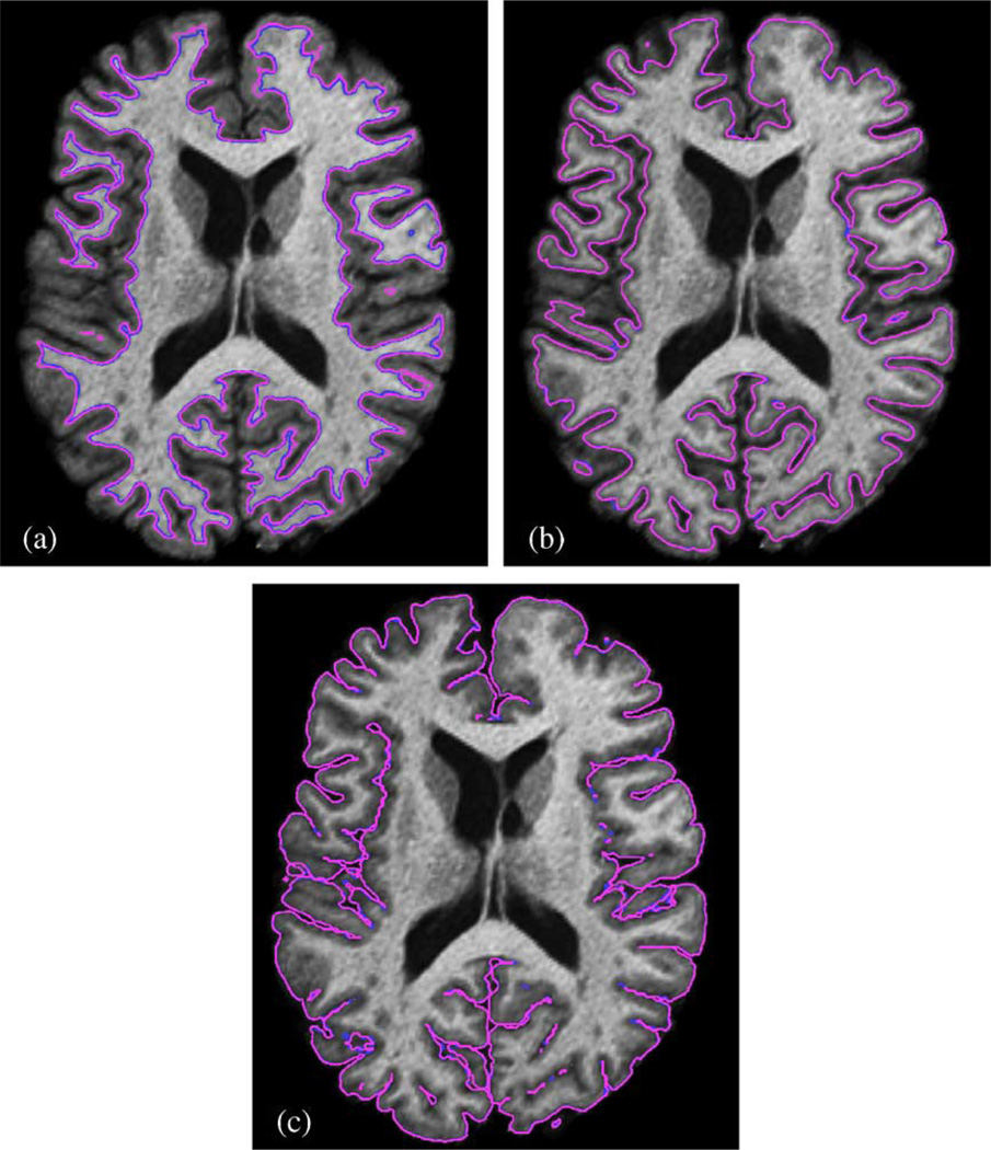 Fig. 10