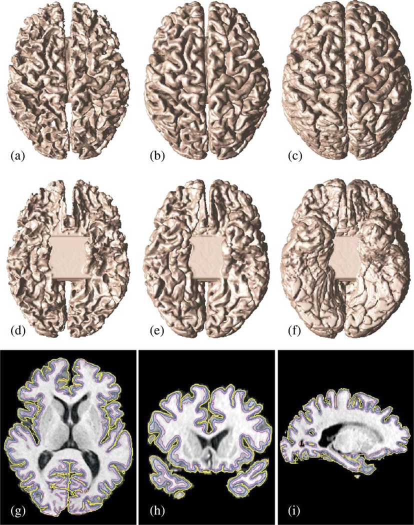 Fig. 4