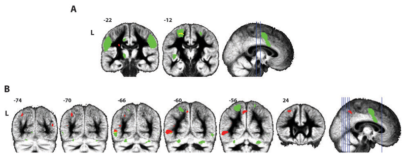 Figure 3.1