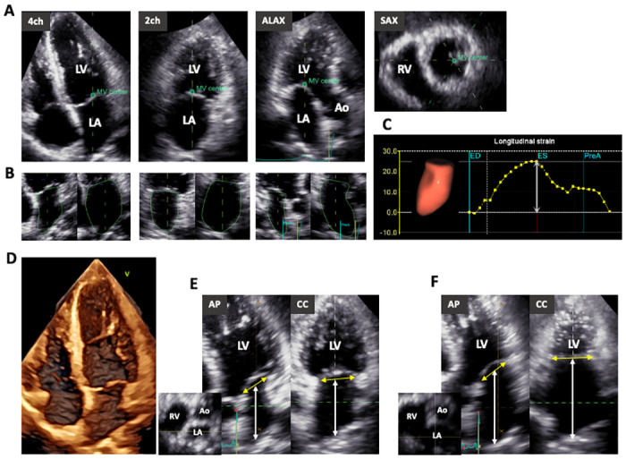 Fig 2