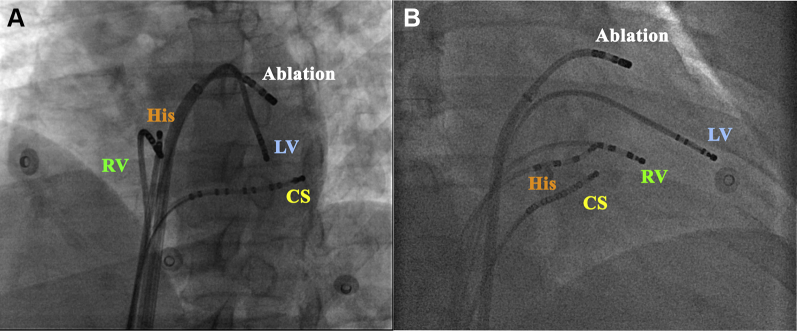 Figure 1