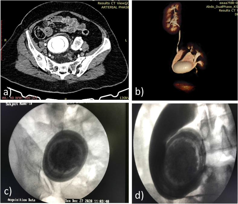 Fig. 2