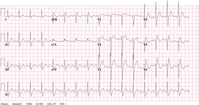 Figure 1