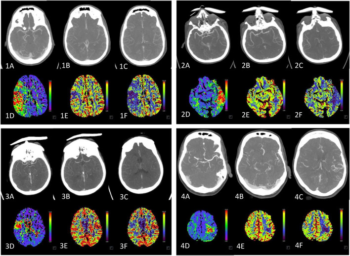 Fig. 3