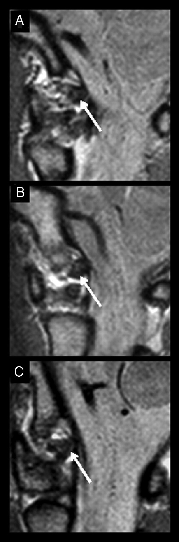 Fig 3.