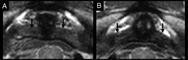 Fig 2.