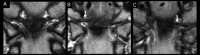 Fig 1.