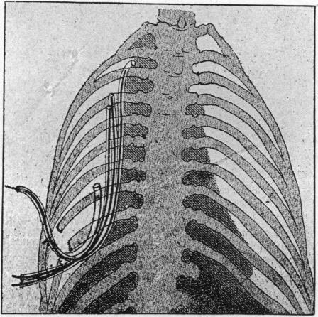 FIG. 10.