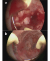 Fig. 4