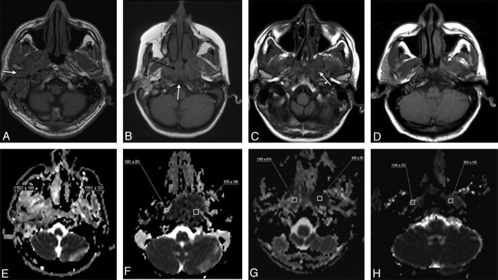 Fig 3.