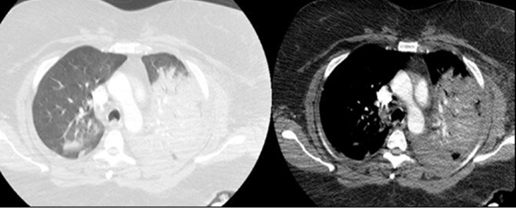 Fig. 2