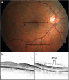 Fig. 3