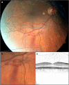 Fig. 2