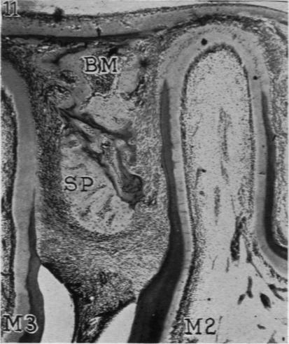 Fig. 11