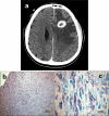 FIG. 1.