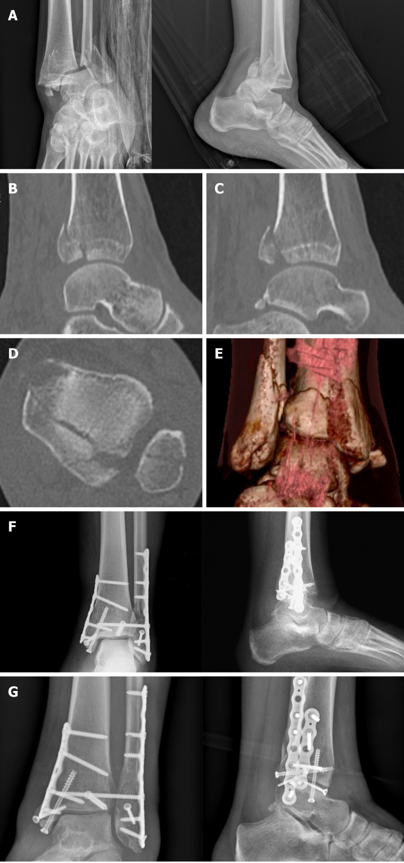 Figure 10