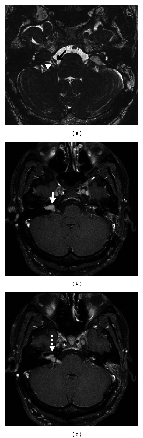 Figure 11