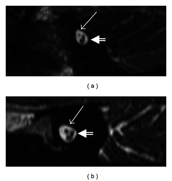 Figure 14