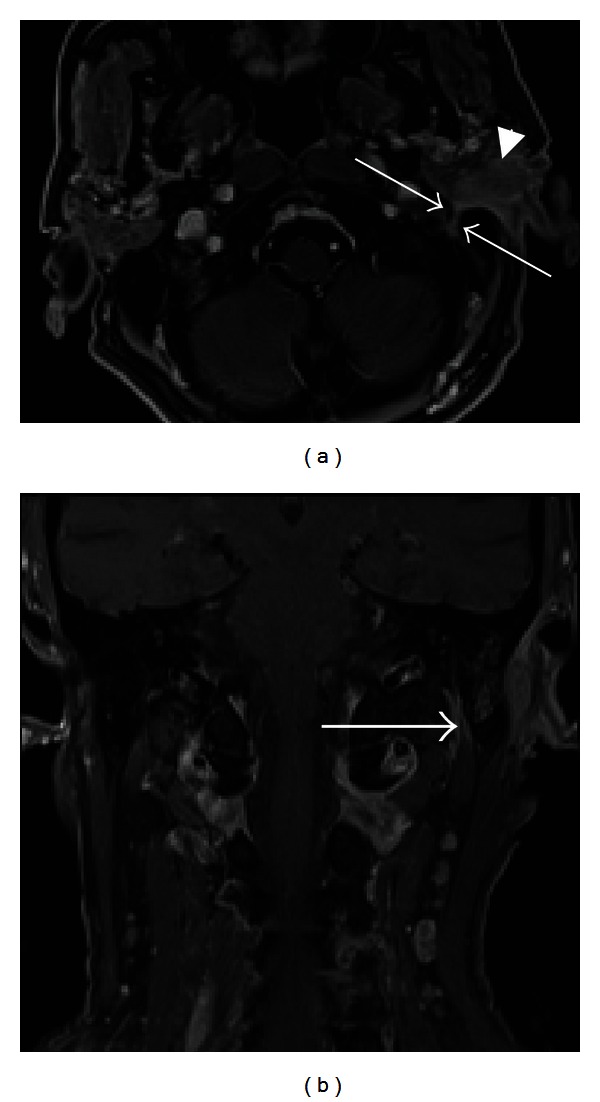 Figure 9