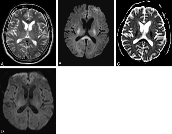 Fig 2.