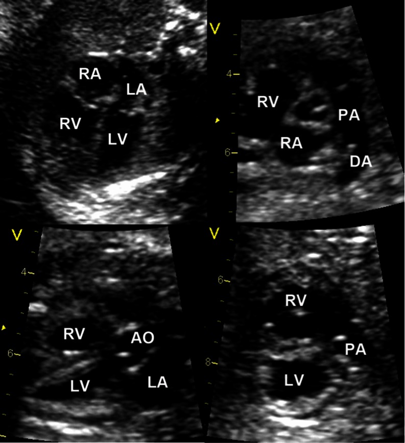 Fig. 3