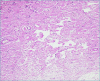 Figure 5B.