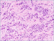 Figure 1B.