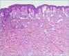 Figure 10A.