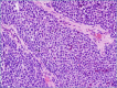 Figure 1C.