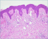 Figure 10B.