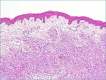 Figure 7A.