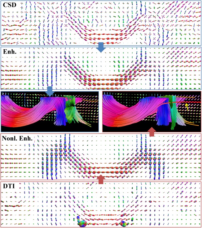 Fig 11