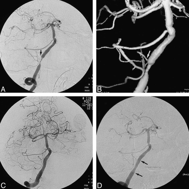 fig 2.