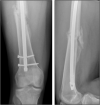 Fig. 4