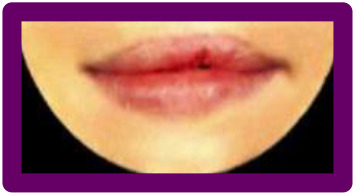 graphic file with name 10.1177_1055665620982801-fig29.jpg