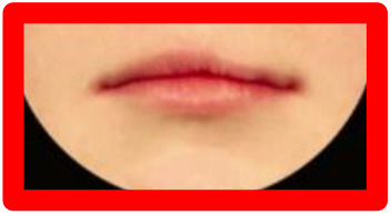 graphic file with name 10.1177_1055665620982801-fig25.jpg