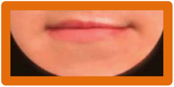 graphic file with name 10.1177_1055665620982801-fig28.jpg