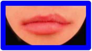 graphic file with name 10.1177_1055665620982801-fig18.jpg