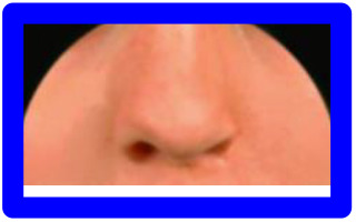 graphic file with name 10.1177_1055665620982801-fig7.jpg