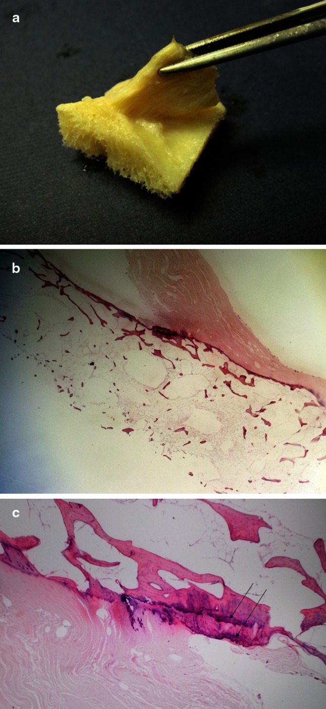 Fig. 4