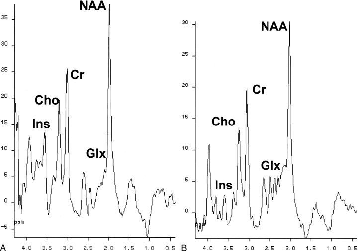 fig 4.