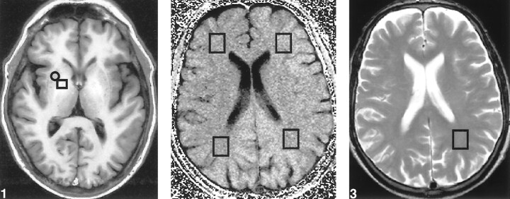 fig 1.