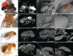 µCT and SEM of mites attached to Drosophilidae.
